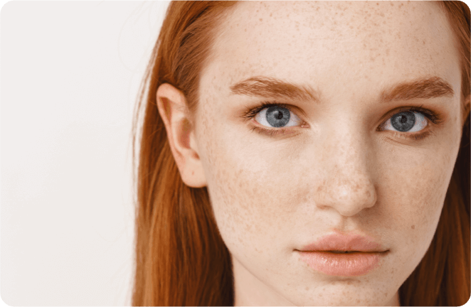 Understanding Skin Type 1